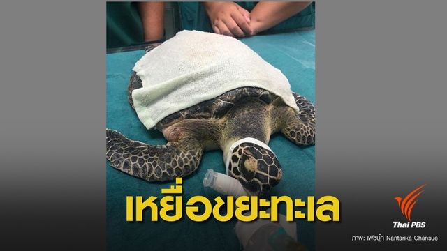 เหยื่อตัวล่าสุด ! ผ่าตัดสำเร็จ “เทรสซี่” เต่าทะเลเกยตื้นขยะเต็มท้อง