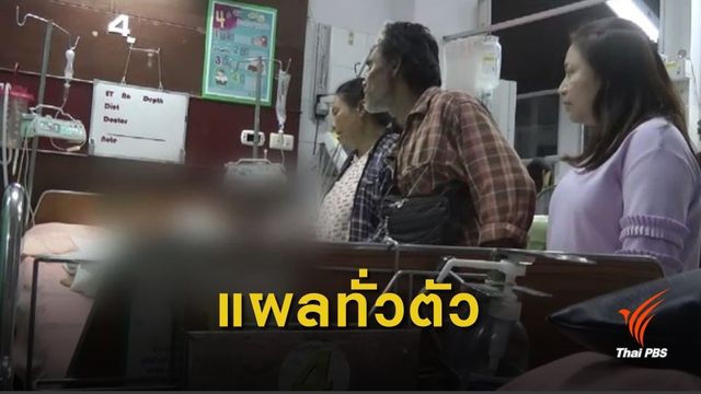 สุนัขจรจัดรุมกัด เด็ก 7 ขวบ อาการสาหัส 