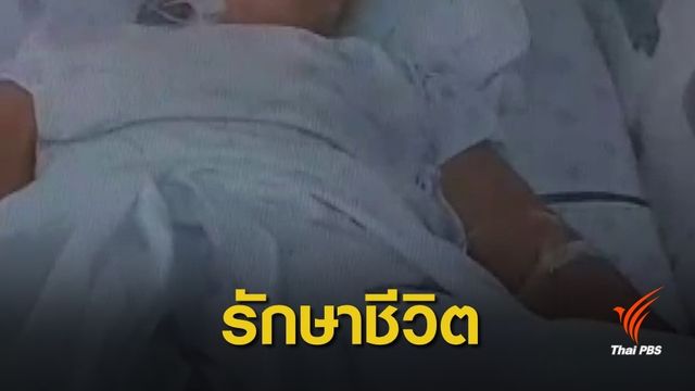 มอ.ออกแถลงการณ์ "ตัดขารักษาชีวิต" สาวถูกสุนัขกัด