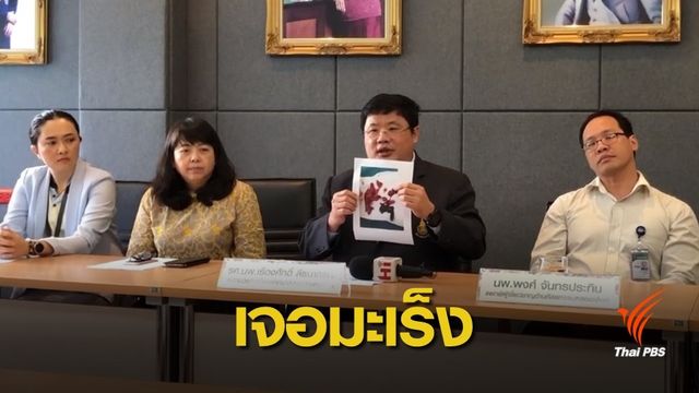 มอ.สรุป "มะเร็งเนื้อรก"ต้นเหตุตัดขา-ไม่เกี่ยวบาดแผลหมากัด 