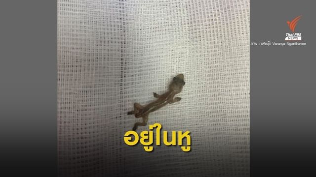 หมอสาว โพสต์สุดอึ้งเจอเคส "จิ้งจก" เข้าหูคนไข้ 