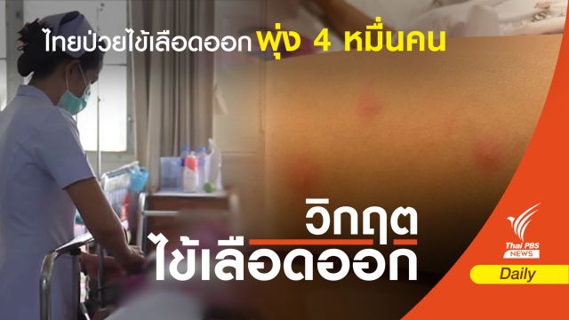 ครึ่งปีแรกป่วยกว่า 4 หมื่นคน สูงสุดใน 5 ปี ตายแล้ว 62 คน