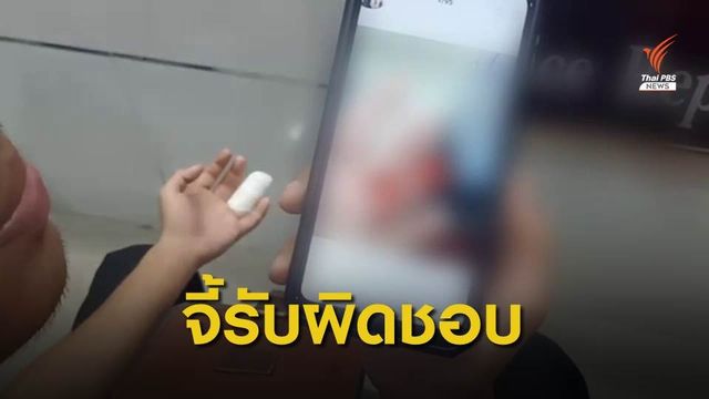 ประตูรถเมล์หนีบนิ้ว นศ.ขาด ขณะลงจากรถ จ.สมุทรปราการ