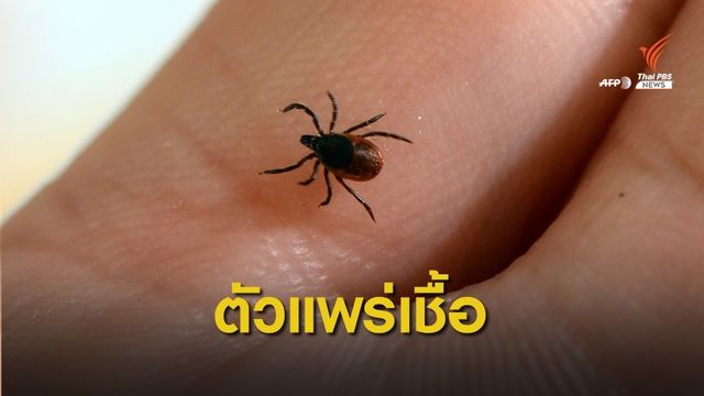 หมอเตือนระวังถูกเห็บกัดเสี่ยงป่วย "โรคลายม์"