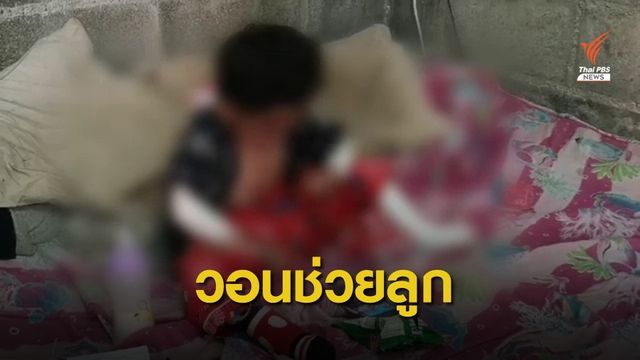 แม่วอนช่วยลูก 2 ขวบ ป่วย "โรคผีเสื้อ" แผลพุพองทั่วร่างกาย  