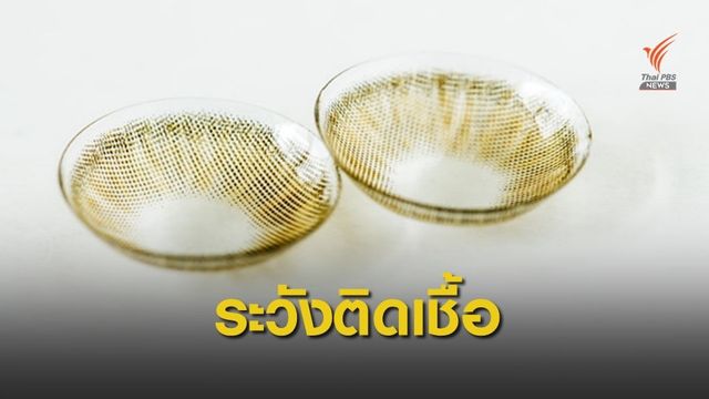 หมอเตือนใช้คอนแทคเลนส์ร่วมกัน เสี่ยงติดเชื้อไวรัสเอดส์-ตับอักเสบ