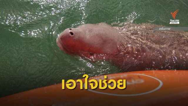 ระดมทีมช่วย "มาเรียม" ติดเชื้อในกระแสเลือด-ปอดอักเสบ
