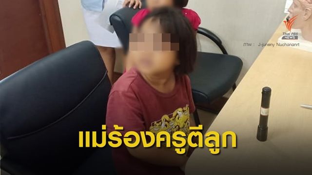 แม่ร้องโซเชียล ครูใช้ไม้ตีลูกจนหน้าช้ำเลือด เหตุบวกเลขช้า 