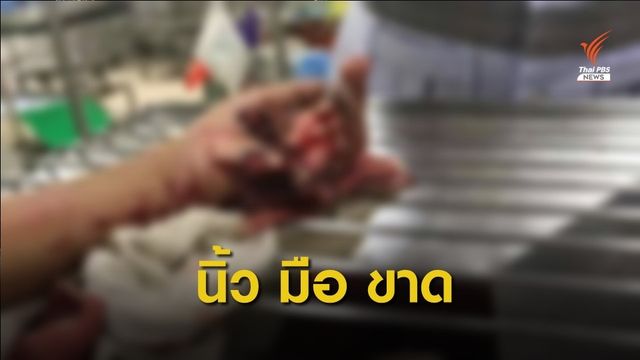คุมยาก! จ.อุดรธานี จุดพลุ-ประทัด บาดเจ็บ 43 คน หนักสุด "มือขาด"  