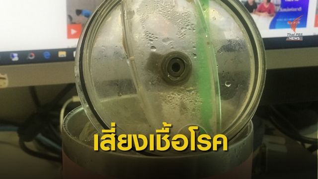 จุดเสี่ยง! เตือนขอบยางแก้วเก็บความเย็น "สะสมเชื้อโรค"  