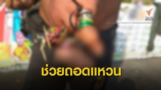 ช่วยได้แล้ว! ชายใส่แหวน - หนังยางรัดนิ้วจนบวมอักเสบ