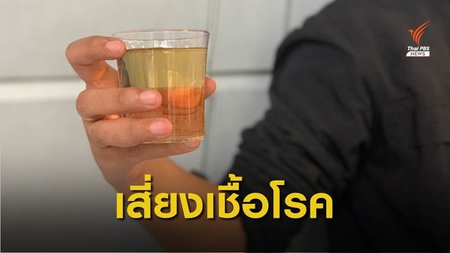 สธ.เตือน "ดื่มฉี่รักษาโรค" อาจทรุดมากกว่าทรง