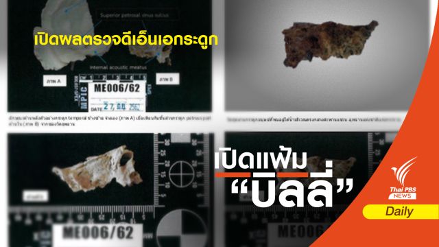 เปิดหลักฐาน ผลตรวจ DNA กระดูกที่พบในแก่งกระจาน