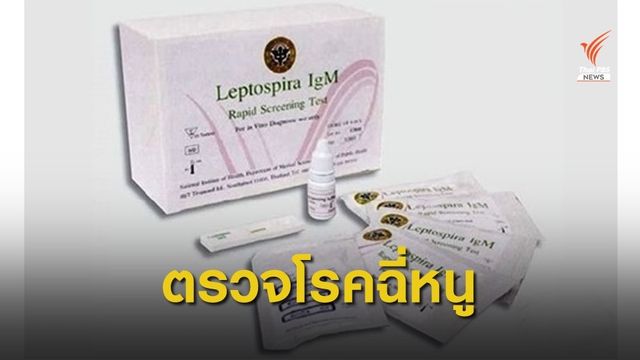 ชุดตรวจโรคฉี่หนู รู้ผลไม่เกิน 10 นาที ช่วยรักษาผู้ป่วยได้ทัน 
