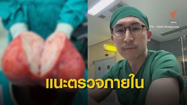 ตะลึง! หมอเปิดภาพ "เนื้องอกกล้ามเนื้อมดลูก" ใหญ่ 20 ซม. 