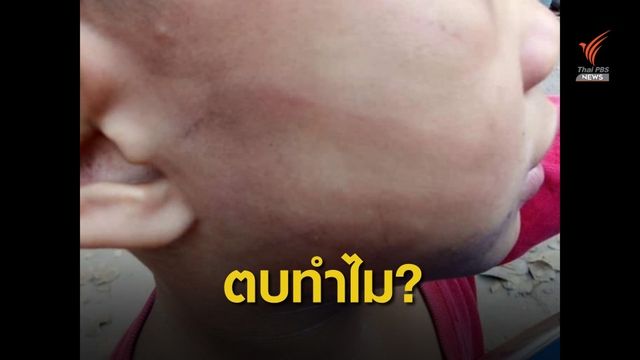 อบต.ฉุนตบหน้าเด็ก 6 ขวบตกจักรยาน ปมทับรถบังคับลูกสาวพัง