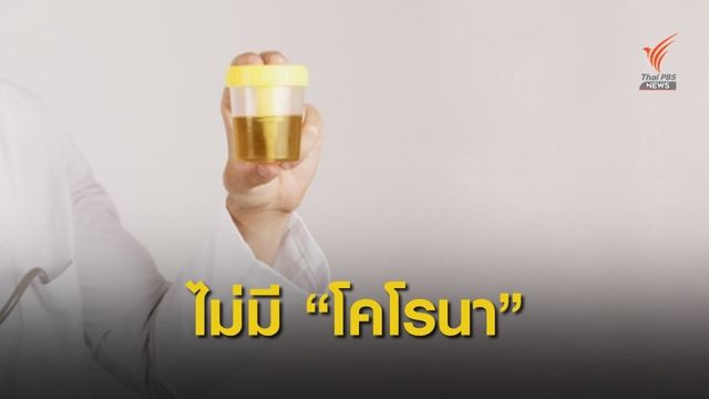 กรมควบคุมโรค ชี้ "ปัสสาวะ" ไม่แพร่เชื้อไวรัสโคโรนา 