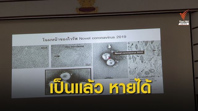 ไวรัสโคโรนาฯ รักษาได้ ไม่ใช่เป็นแล้วตายทุกคน