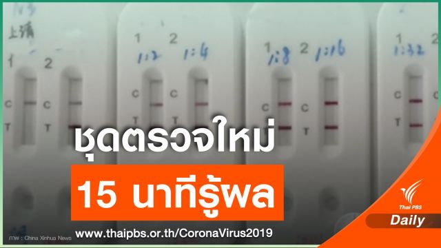 จีนพัฒนาชุดตรวจ COVID-19 ใช้เลือด 1 หยด รู้ผลใน 15 นาที