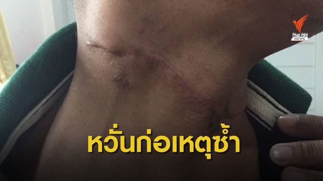 ร้อง ตร.เร่งติดตามผู้ก่อเหตุทำร้ายร่างกาย ย่านตลาดโบ๊เบ๊ กทม.
