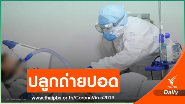 ทีมแพทย์จีนปลูกถ่ายปอด 2 ข้างให้ผู้ติดเชื้อ COVID-19 สำเร็จ