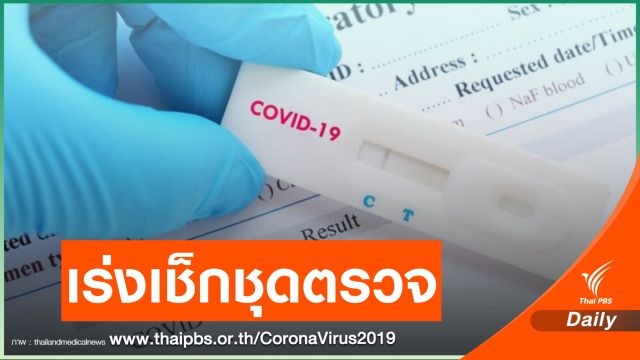 สธ.เร่งเช็กชุดตรวจ COVID-19 ย้ำหากเป็นบวกต้องตรวจแล็ปซ้ำ