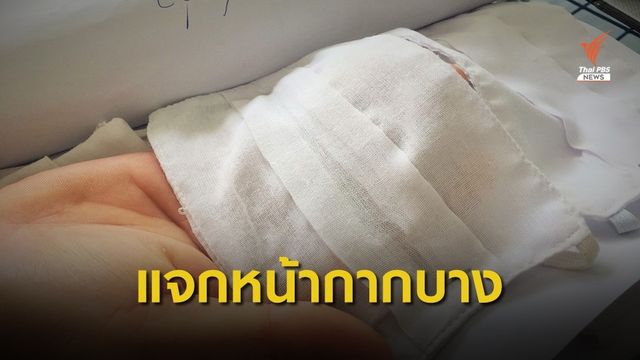ตรวจสอบ อปท.แจกหน้ากากผ้าบาง