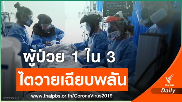 นักวิจัยสหรัฐฯ ชี้ 1 ใน 3 ของคนไข้ COVID-19 ไตวายเฉียบพลัน