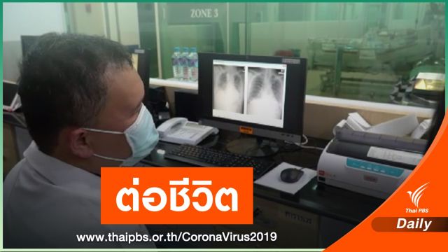 เปิดใจทีมแพทย์-ผู้บริจาค "พลาสมา"ต่อชีวิตผู้ป่วยสำเร็จ