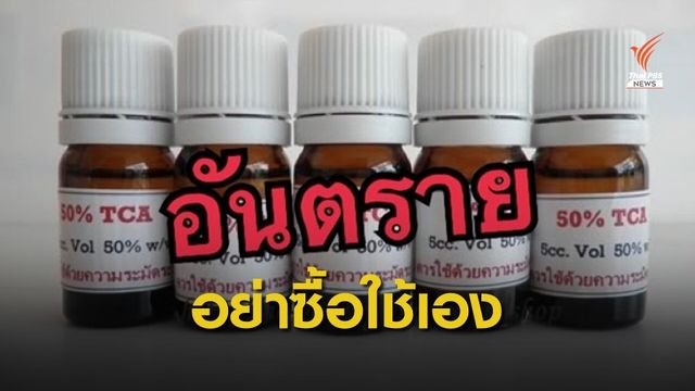 อย.เตือนวัยรุ่นอย่าซื้อกรดทีซีเอมาใช้เอง เสี่ยงหน้าพังถาวร