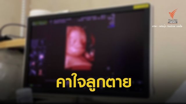 คาใจแม่ท้อง 6 เดือนทำ "อัลตราซาวด์ 4D" สุดท้ายเสียลูก 