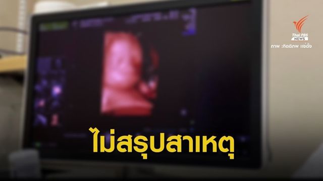 สบส.ยังไม่สรุปปมอัลตราซาวด์ 4D แต่แท้งลูก 