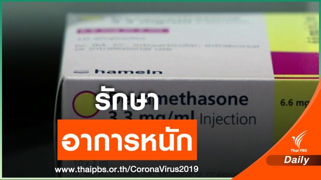 นักวิจัยอังกฤษพบยากลุ่มยาสเตียรอยด์ ช่วยรักษาผู้ป่วย COVID-19 