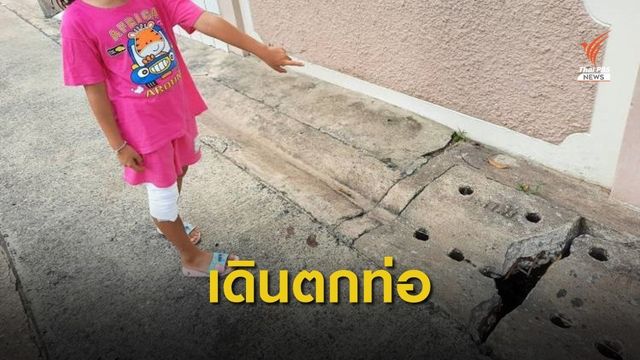 ลูกสาว 6 ขวบตกท่อ เย็บ 12 เข็ม ภาษีเจริญ กทม.