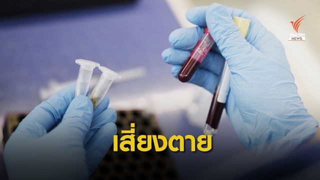 หมอเตือน "ติดเชื้อในกระแสเลือด" เสี่ยงอันตรายถึงชีวิต