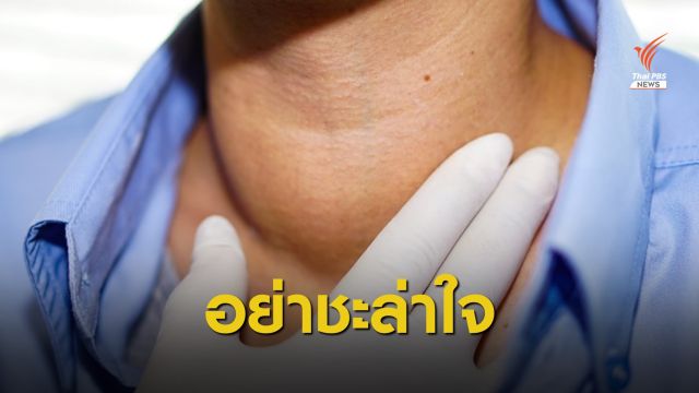 คลำพบก้อนที่คอเสี่ยง "มะเร็งไทรอยด์" ตรวจเร็ว รักษาหาย