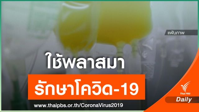 สหรัฐฯ ไฟเขียวใช้พลาสมารักษาผู้ป่วย COVID-19