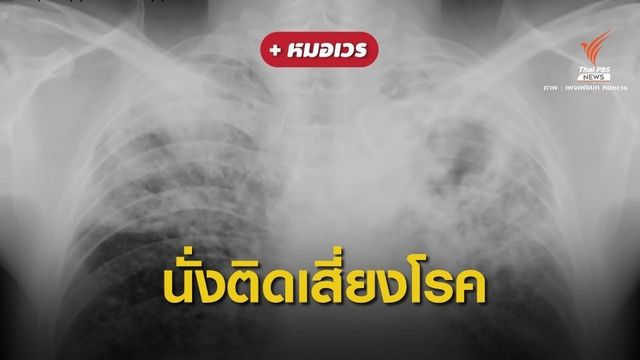 หมอเตือน! รู้ทัน "วัณโรคปอด" นั่งข้างกันติดได้ 