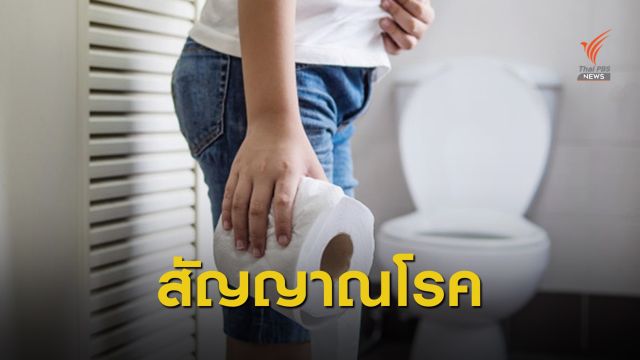 ถ่ายเป็นเลือดสัญญาณเตือน “โรคมะเร็งลำไส้ใหญ่”
