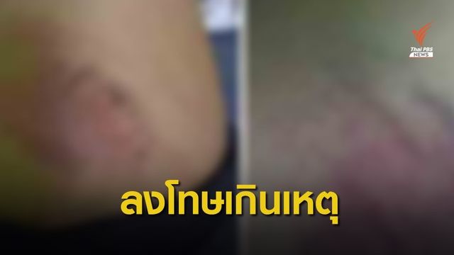 "สระแก้ว" ตั้ัง กก.สอบครูตีเด็กเกินกว่าเหตุ-ส่งทีมเยียวยาถึงบ้าน  