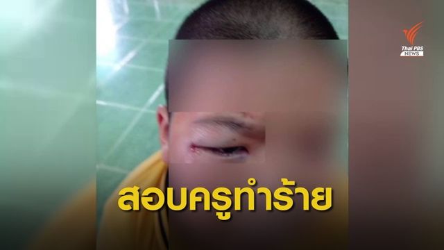 หลายหน่วยงานลงพื้นที่สอบปมครูทำร้ายเด็กอนุบาล 3 บาดเจ็บ