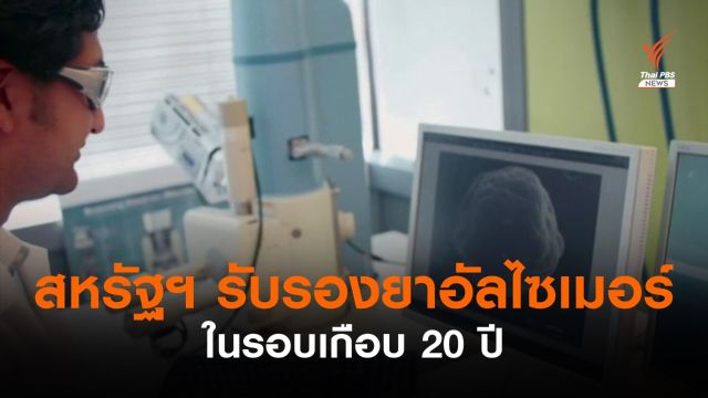 สหรัฐฯ รับรองยารักษาอัลไซเมอร์ตัวใหม่ในรอบ 20 ปี