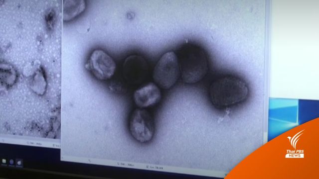 สหรัฐฯ พบสัญญาณ "ฝีดาษลิง" ระบาดในประเทศ