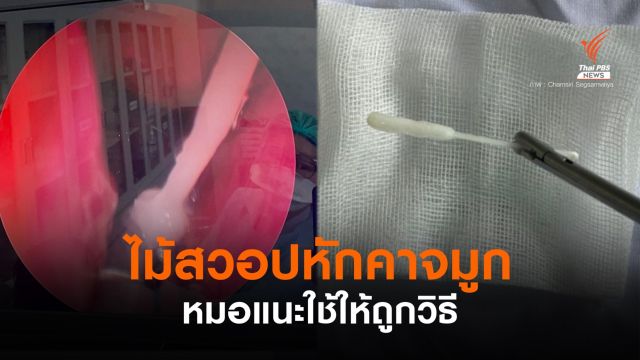 อุทธาหรณ์! ตรวจหาเชื้อโควิดเอง พบ "ไม้สวอป" หักคาจมูก