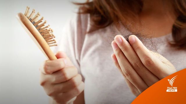 รู้จักโรค "Alopecia areata" ผมร่วงเป็นหย่อม