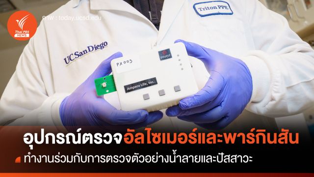 อุปกรณ์พกพาตรวจ "อัลไซเมอร์ - พาร์กินสัน" ผ่านน้ำลายและปัสสาวะ