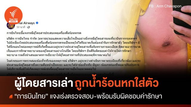 "การบินไทย" แจงเร่งสอบ-พร้อมรับผิดชอบผู้โดยสารถูกน้ำร้อนหกใส่