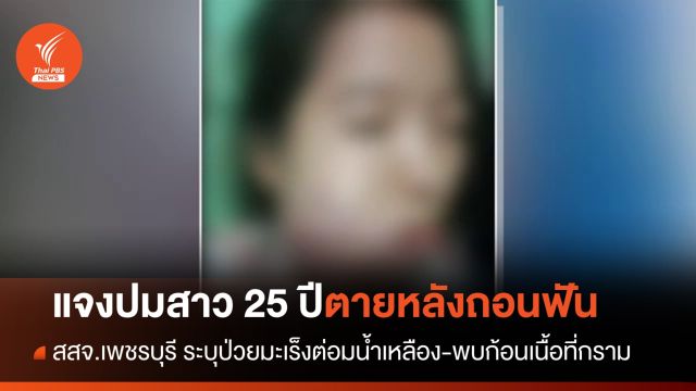 สสจ.เพชรบุรี แจงปมสาว 25 ปีเสียชีวิตหลังถอนฟัน เหตุป่วยมะเร็ง