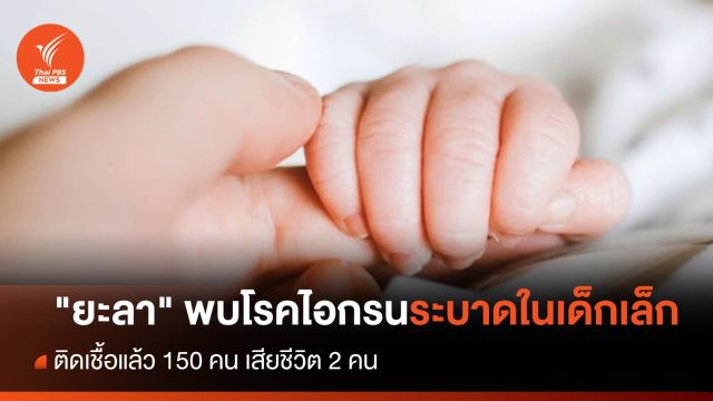 "ยะลา" พบโรคไอกรนระบาดในเด็กเล็ก เสียชีวิต 2 คน 