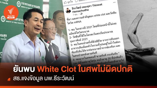 สธ.แจงข้อมูล นพ.ธีระวัฒน์  ยันพบ White Clot ในศพไม่ผิดปกติ